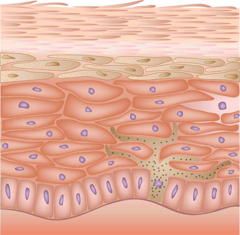 RN, CE, skin, epidermis, dermis, adipose, melanocytes, corneum, skin health
